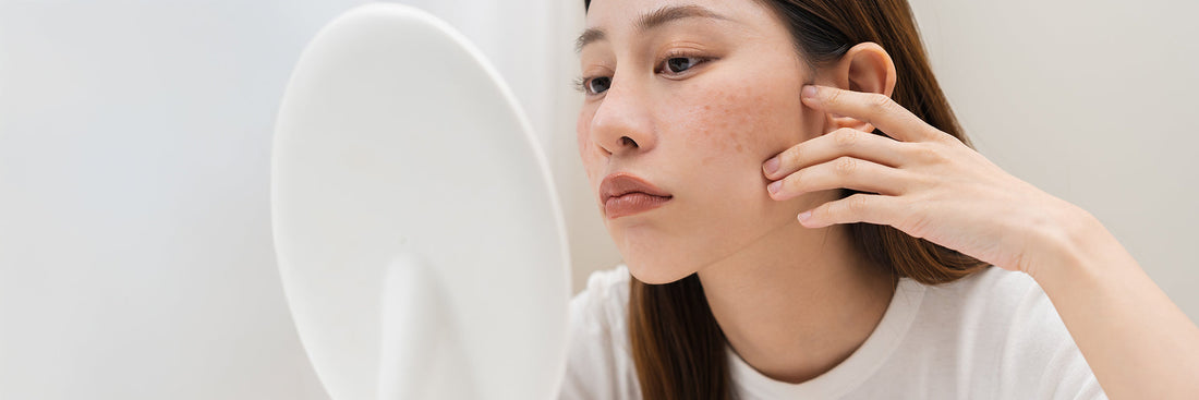 肌の「糖化」とは